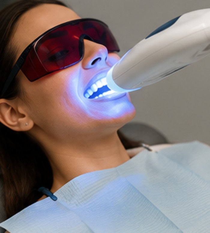 Teeth Whitening at Lumen Dental Studio
